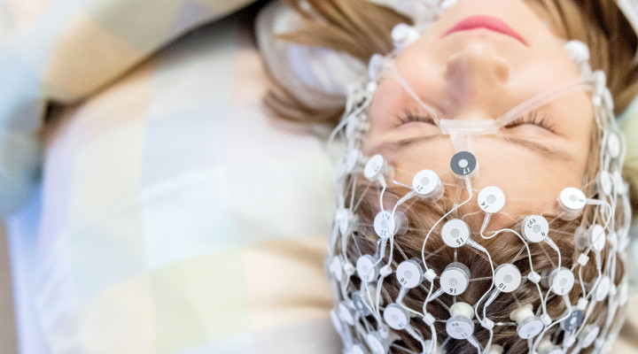 Junges Mädchen mit Elektrodennetz auf dem Kopf während eines Schlaf-EEG.