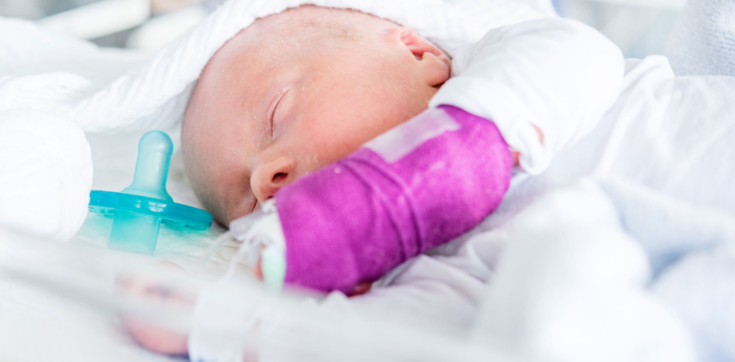 Baby auf der Neonatologie mit lilafarbenem Gips und grünem Schnuller