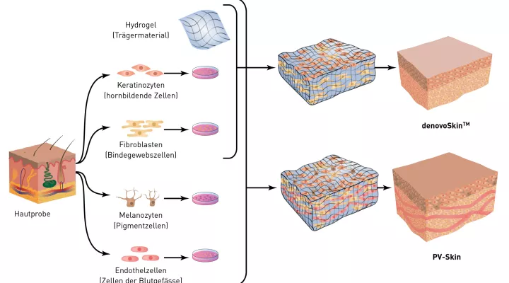 Die Entstehung von Hautersatz