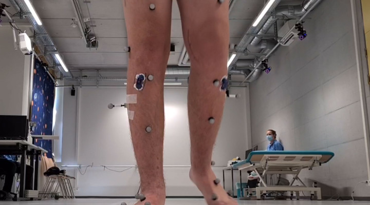 Zwei Beine, an denen Sensoren kleben, im Hintergrund eine Fachperson mit blauem Spitaloberteil.