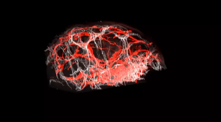 3D-Rekonstruktion gesunder Haut ohne Lymphödem