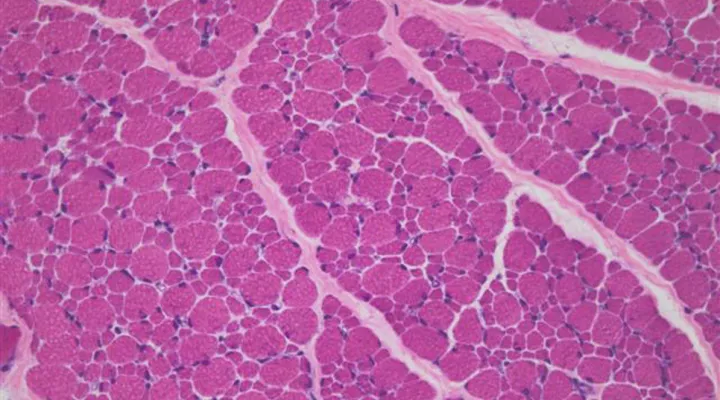 Mikroskopische Aufnahme von menschlichem Muskelgewebe im Querschnitt als Symbolbild für das Neuromuskuläre Symposium 2025