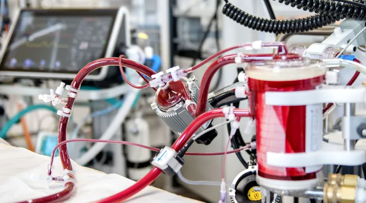 Herzchirurgie, ECMO auf Intensivstation