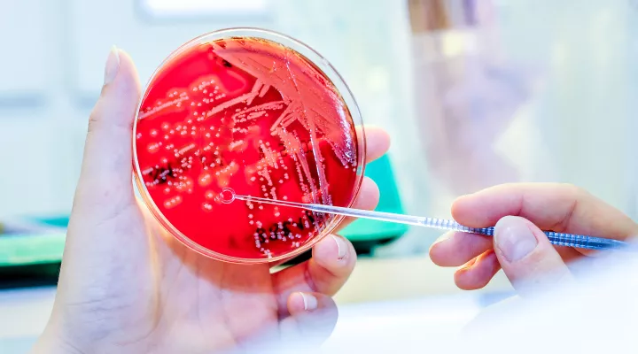 Infektiologie, Laborantin ruehrt mit einem Stab in der Petrischale
