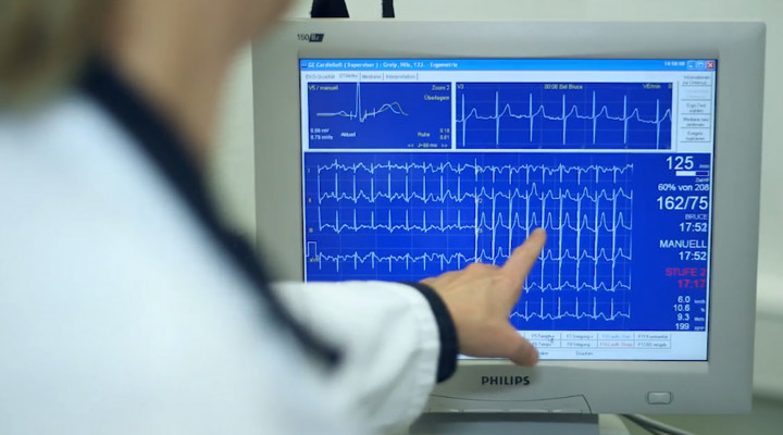Eine Ärztin zeigt auf einen Bildschirm mit Herzlinien.