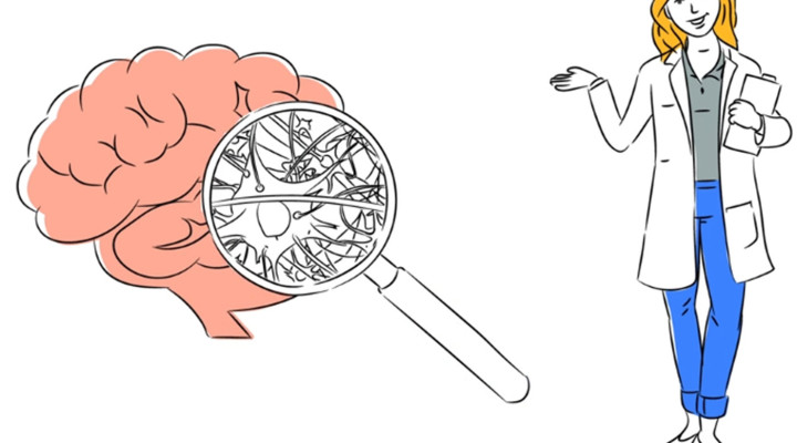 Eine gezeichnete Ärztin zeigt auf ein überdimensionales Hirn, auf welchem eine überdimensionale Lupe liegt. 
