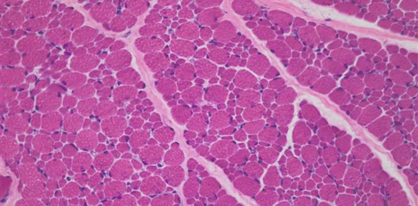 Mikroskopische Aufnahme von menschlichem Muskelgewebe im Querschnitt als Symbolbild für das Neuromuskuläre Symposium 2025