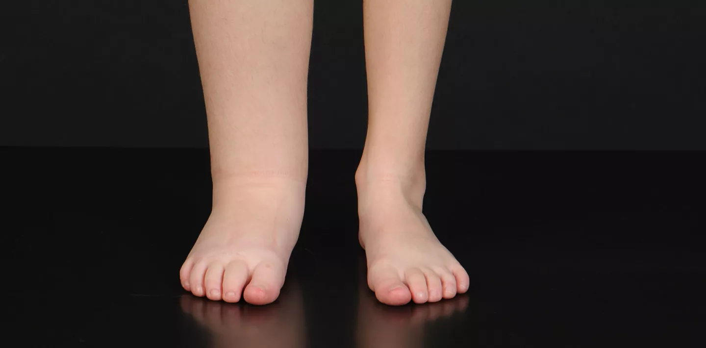 Alina Bektashi, Patientin Zentrum Kinderhaut, Forschungsmagazin 2022