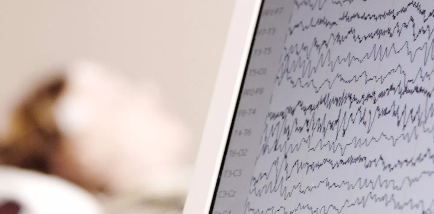 Bildschirm mit Hirnstroemen während eines EEG