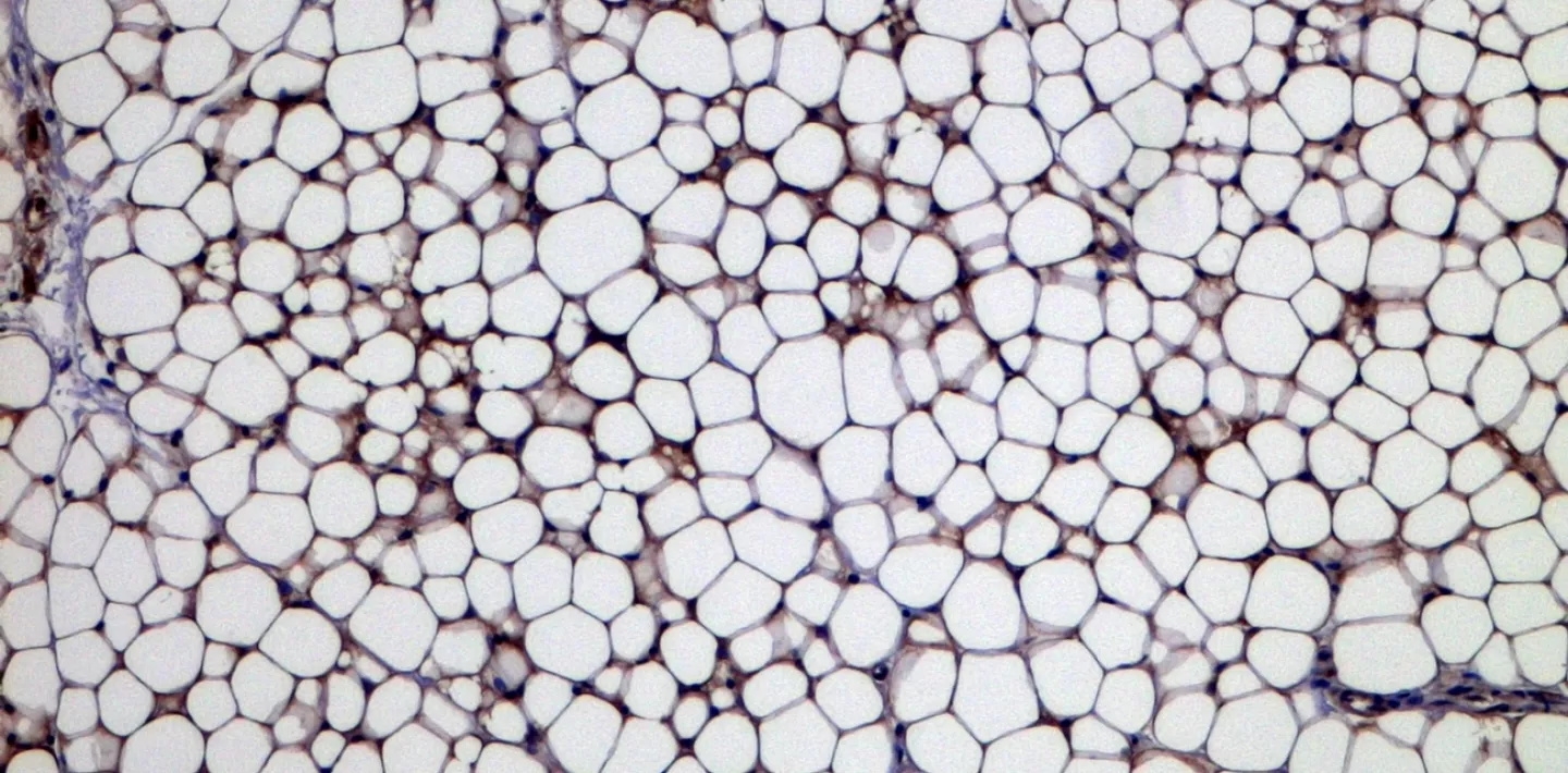 gebräunte Fettzellen