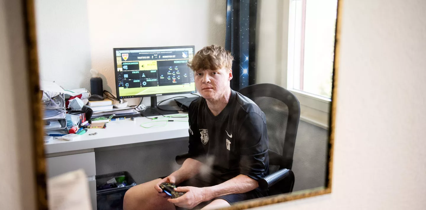 Guus van Eck, brandverletzt, beim Gamen zu Hause