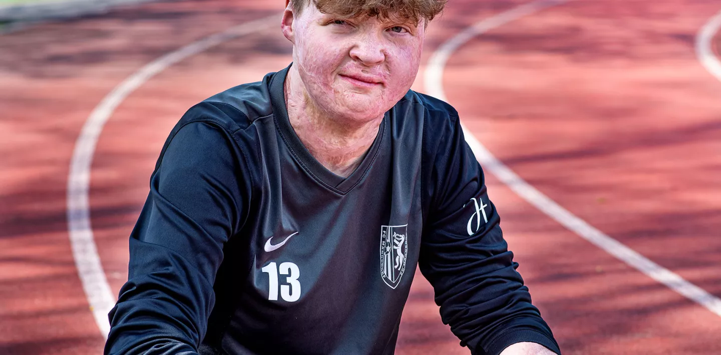 Guus van Eck, brandverletzt, spielt gerne Fussball