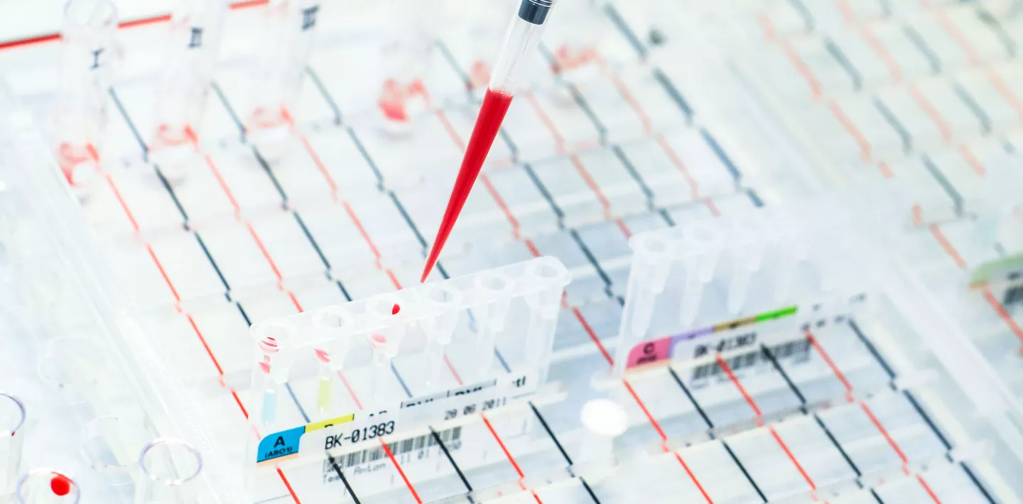 Infektiologie, Laborantin pipettiert Loesung in Testbehaelter