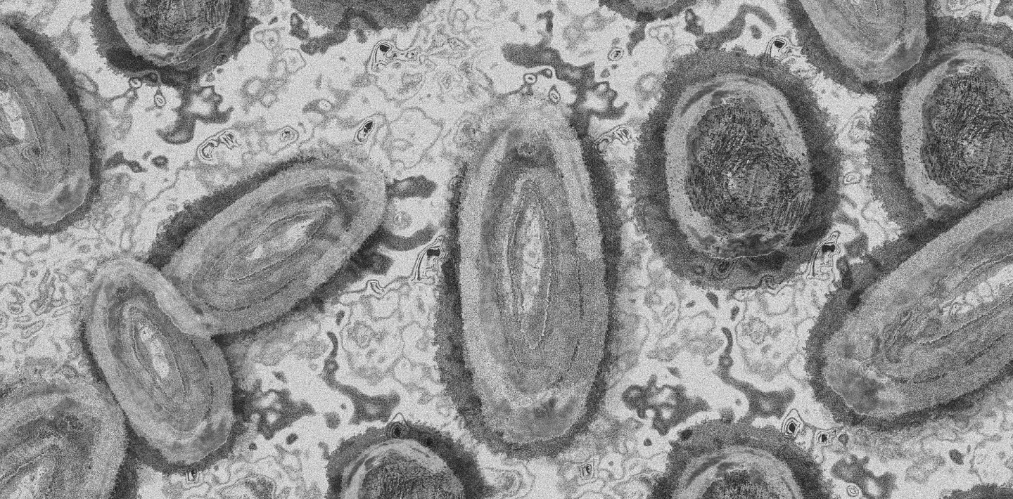 Aufnahme von Affenpocken