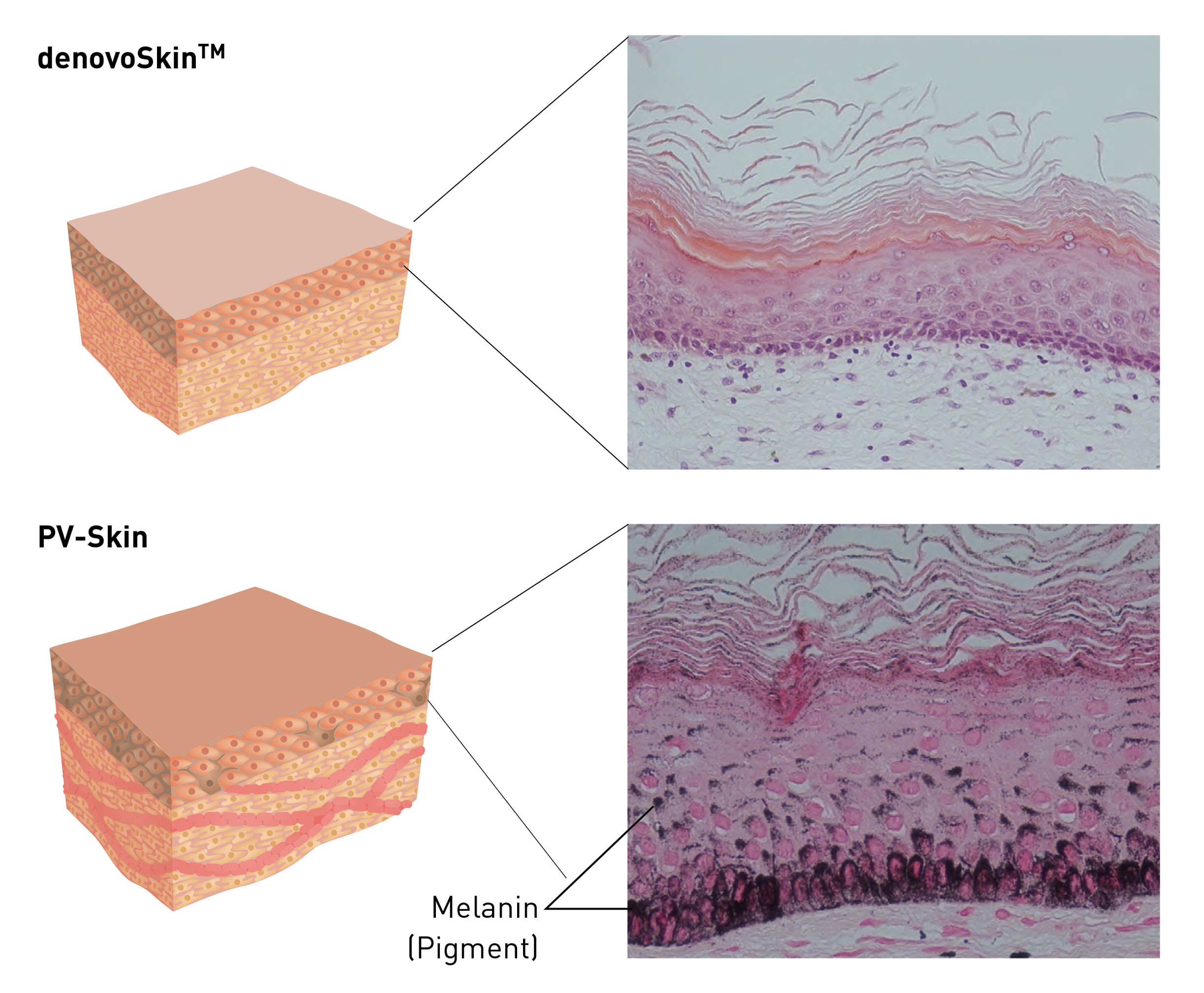 denovoSkin™ und PV-Skin mit histologischem Schnitt