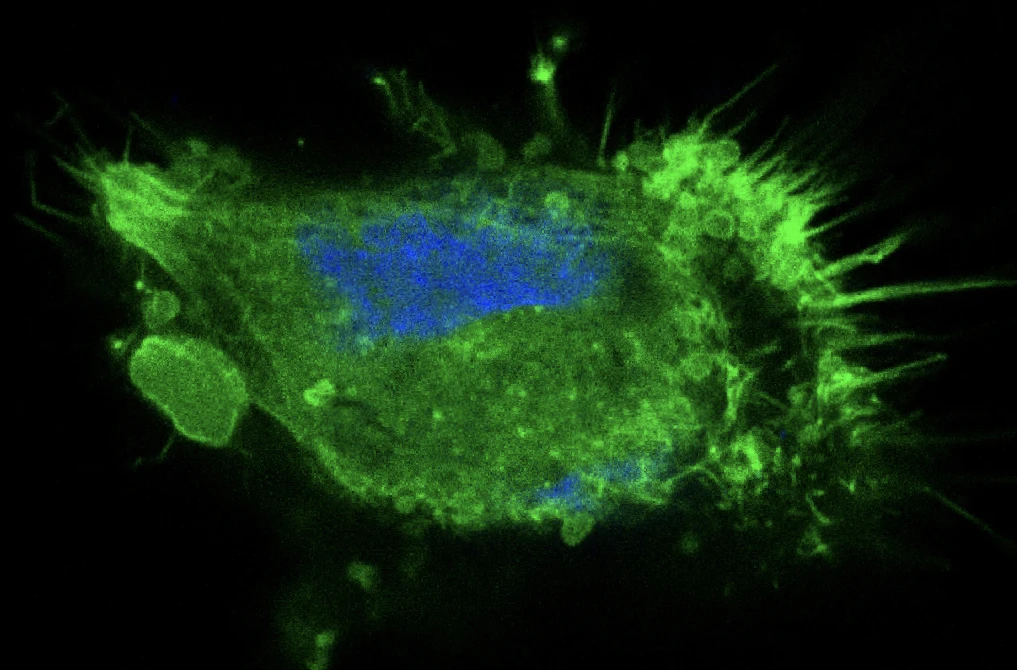 Molekulare-Neuroonkologie-Forschung-The invading cell