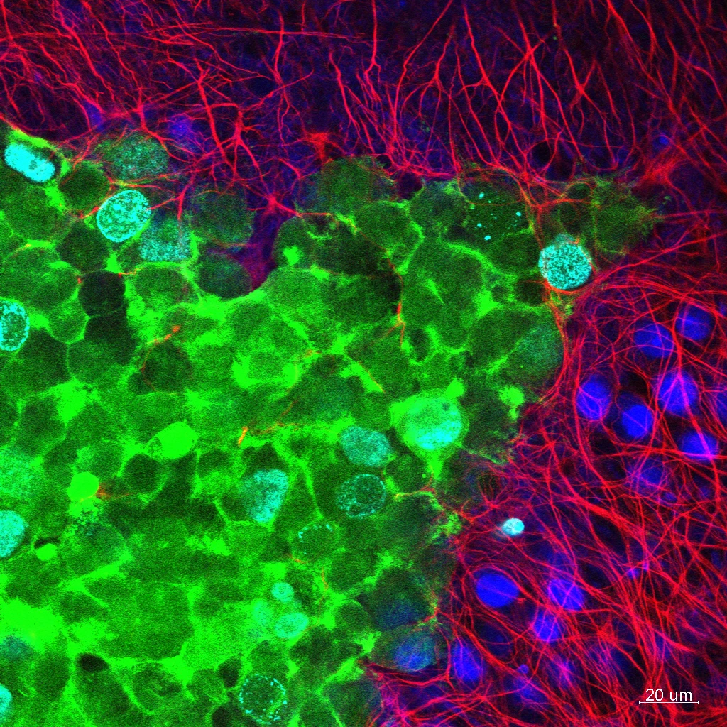 Molekulare-Neuroonkologie-Forschung-egf 63x_4_001