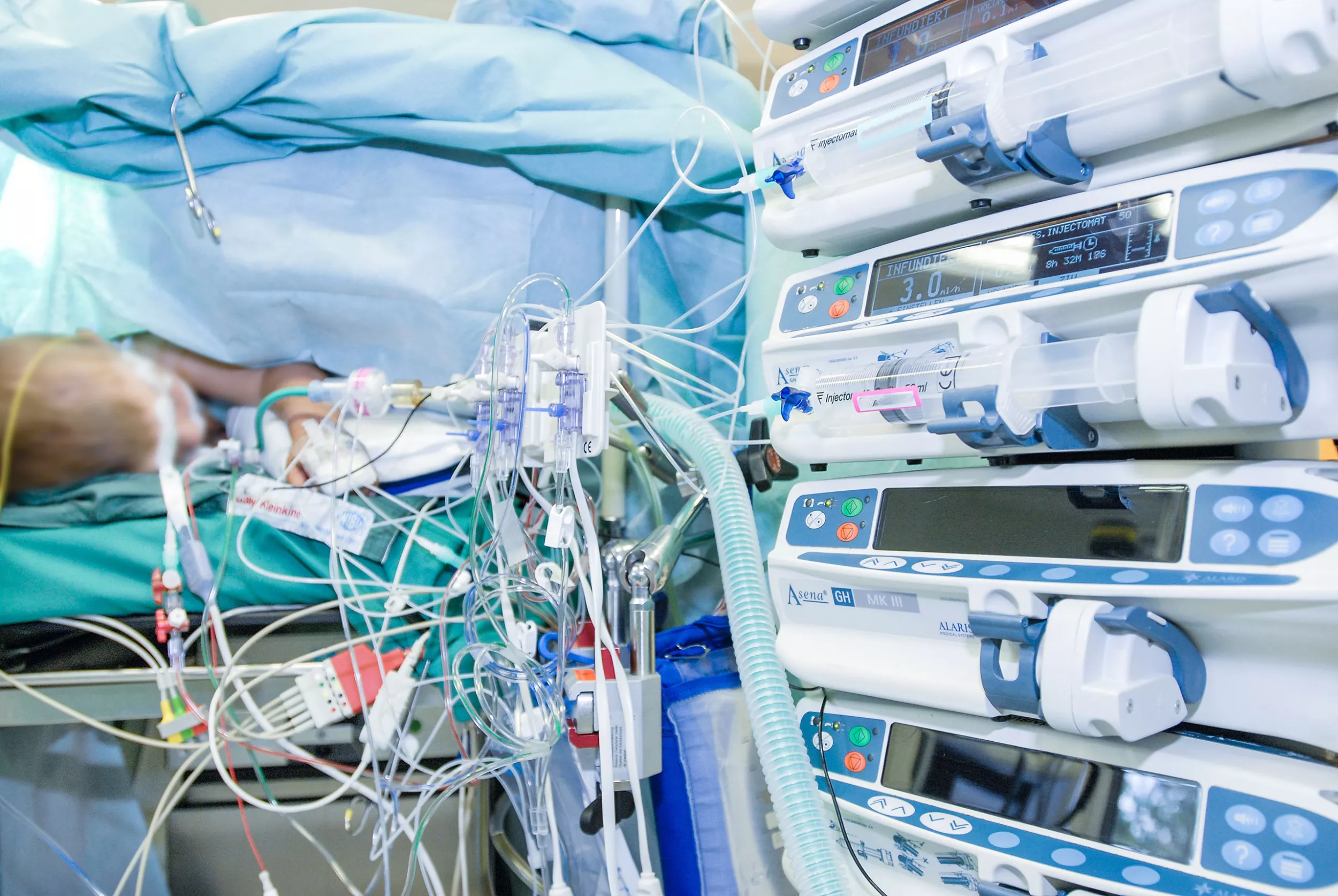 im OP, Medikamententurm und viele Kabel zur Anästhesie des Patienten