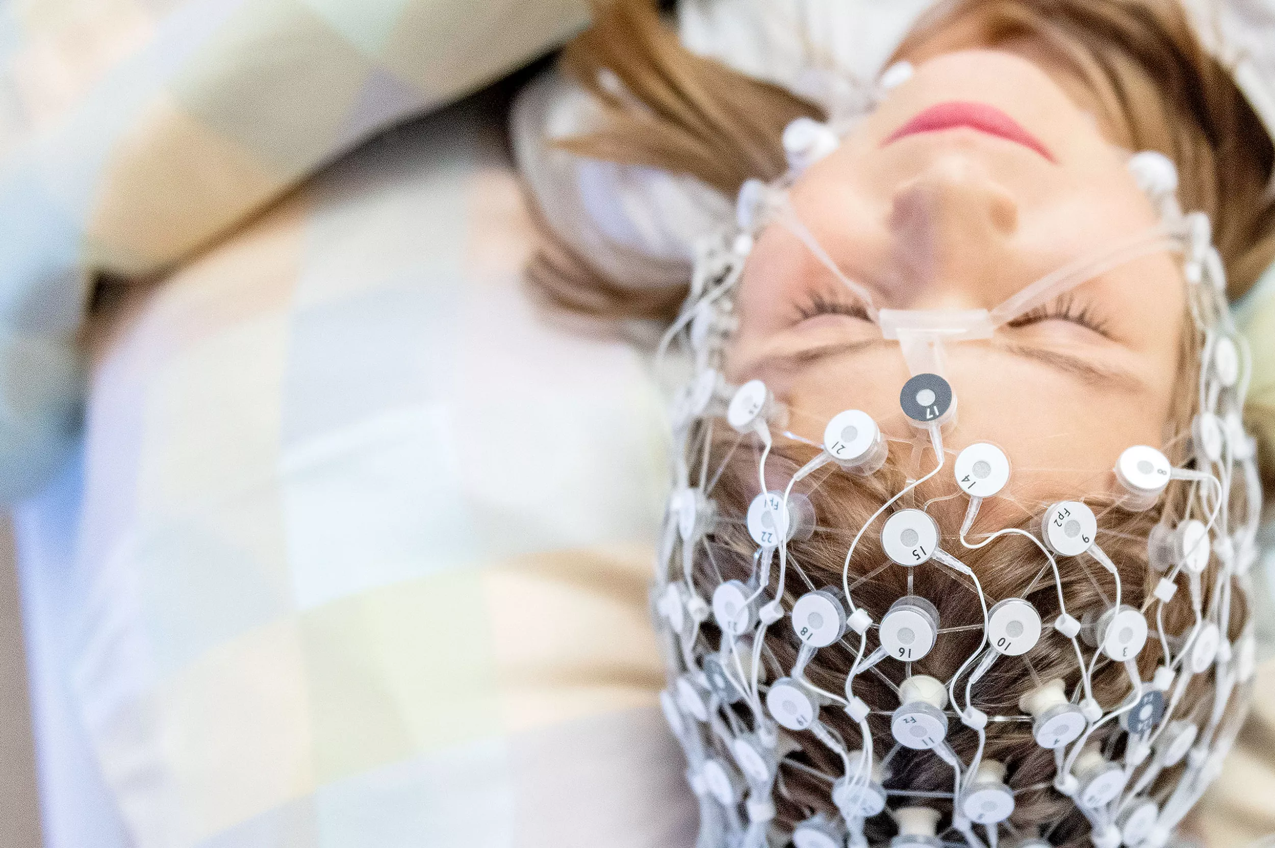 Junges Mädchen mit Elektrodennetz auf dem Kopf während eines Schlaf-EEG.