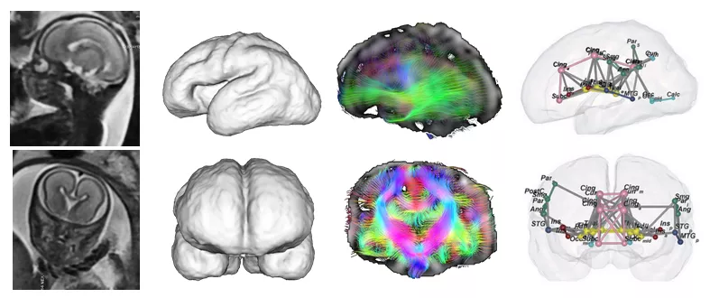 fetal developmental imaging