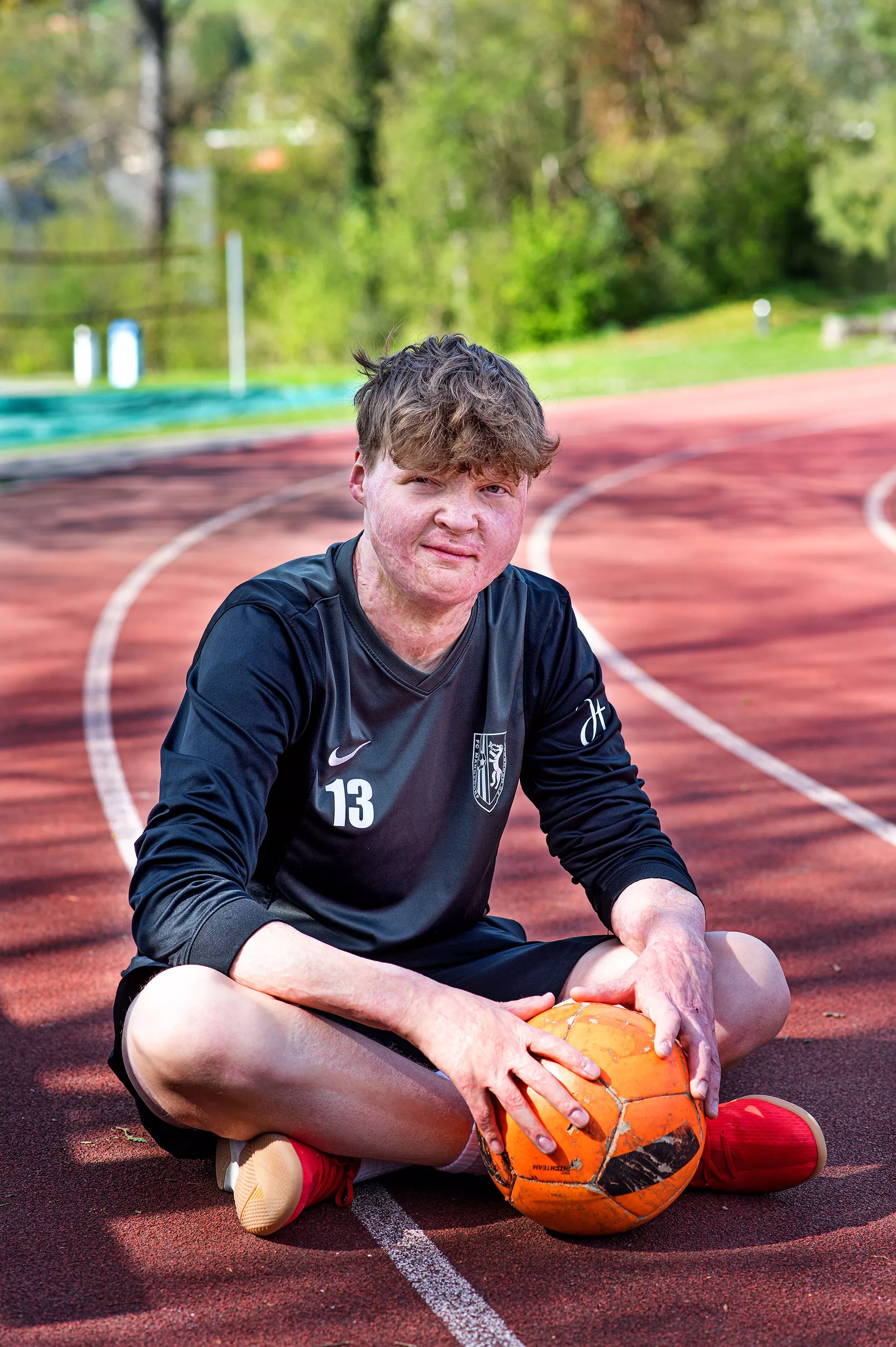 Guus, brandverletzt, spielt gerne Fussball