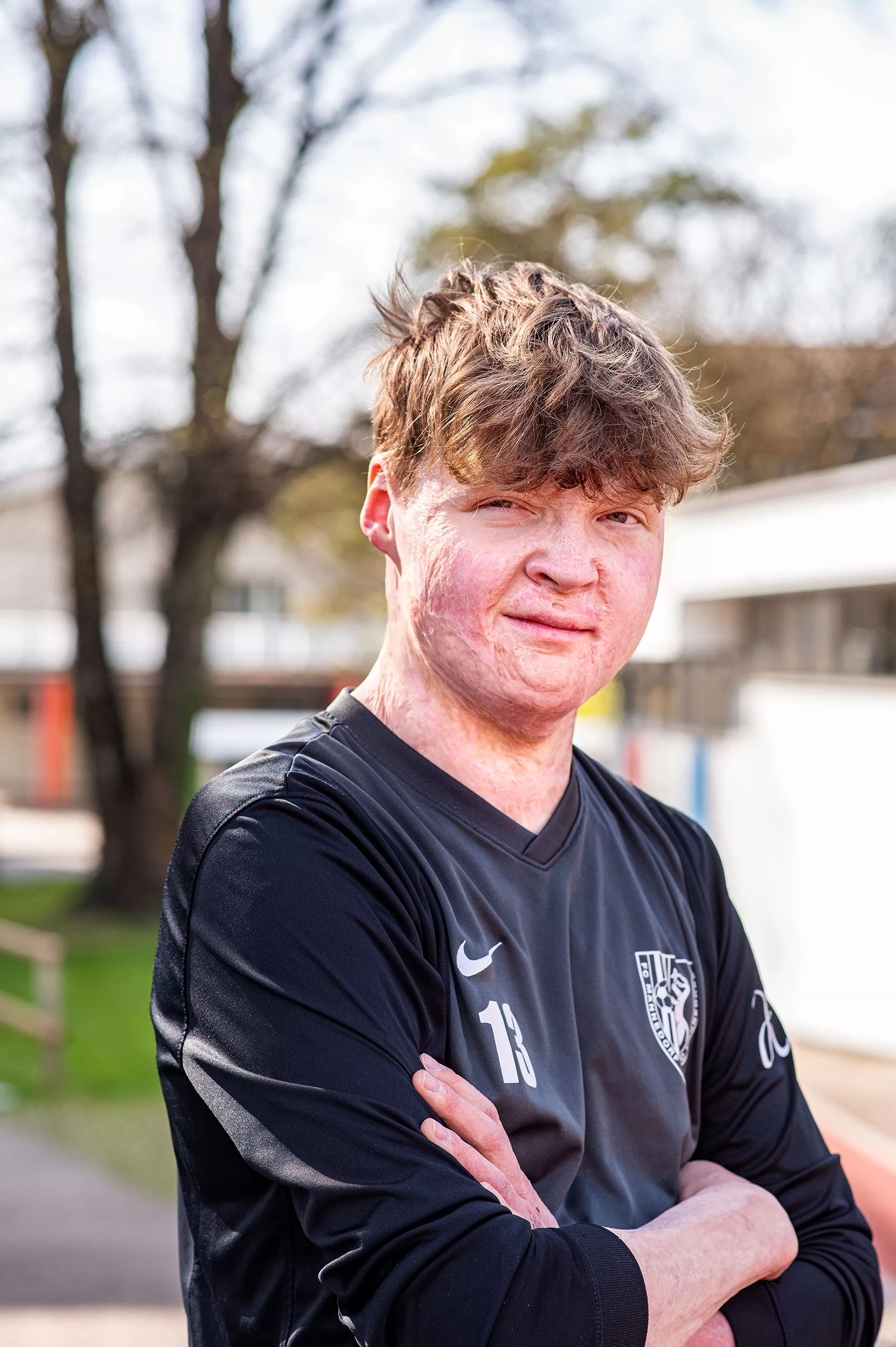 Guus, brandverletzt, spielt gerne Fussball