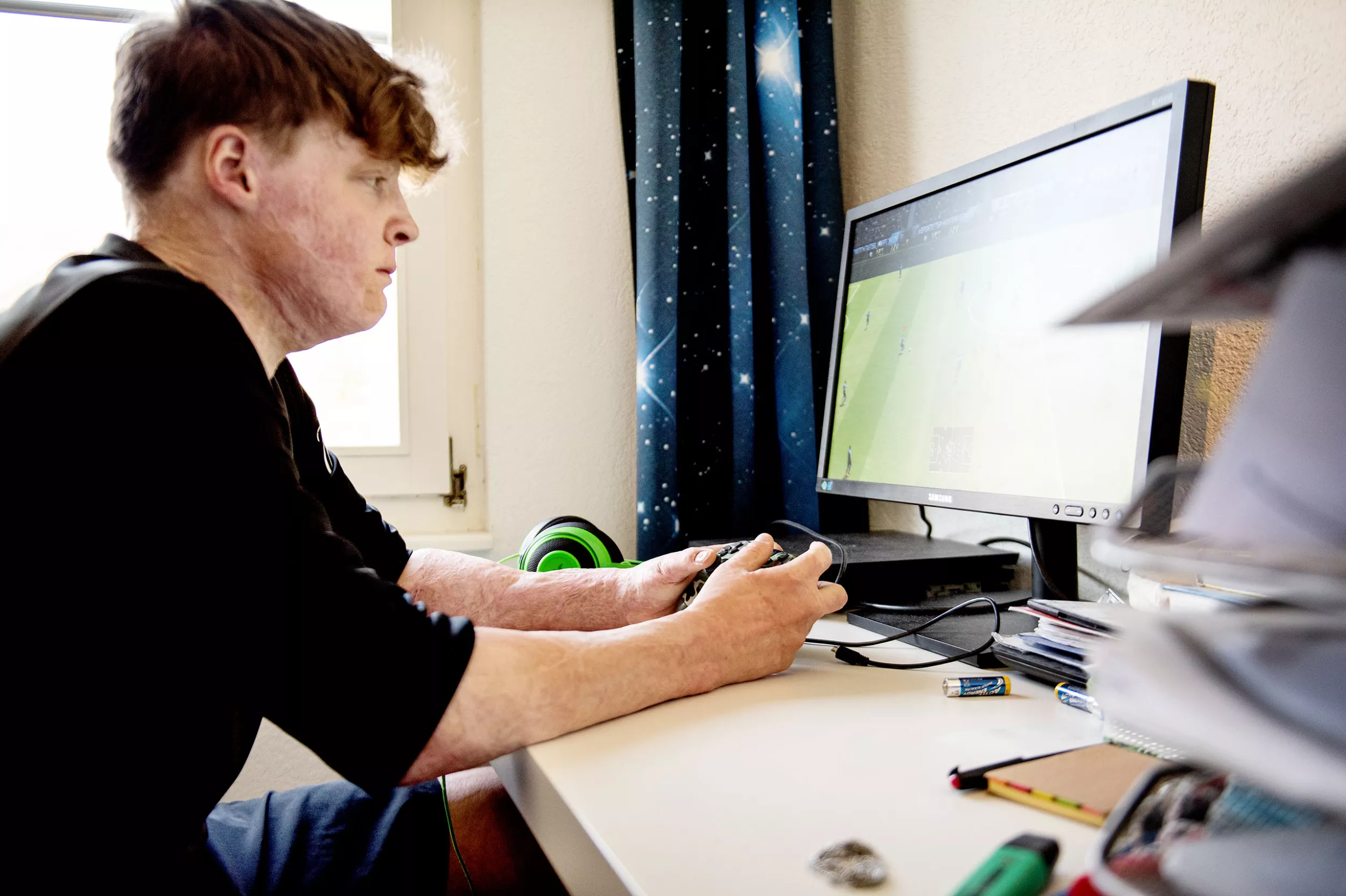 Guus, brandverletzt, beim Gamen zu Hause