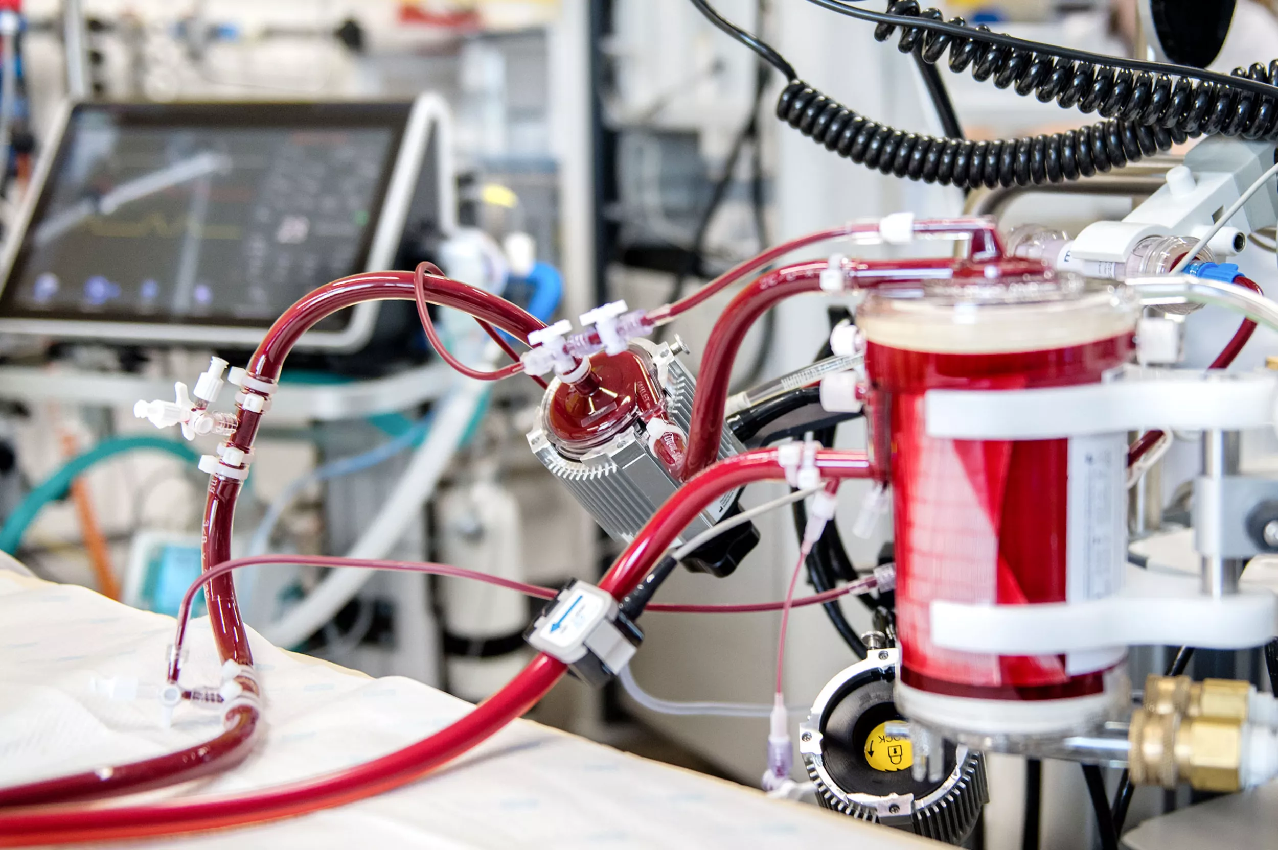 Herzchirurgie, ECMO auf Intensivstation