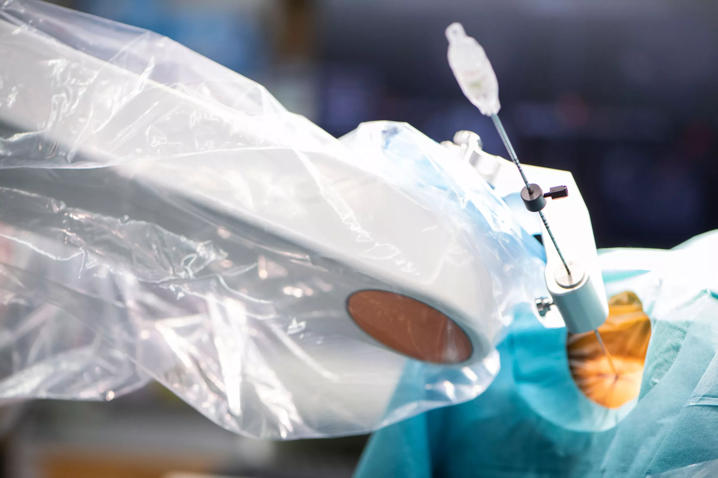 Ein Foto von einem Roboter neuromate, der umfassende Lösung für ein breites Spektrum von funktionellen neurochirurgischen Eingriffen bietet