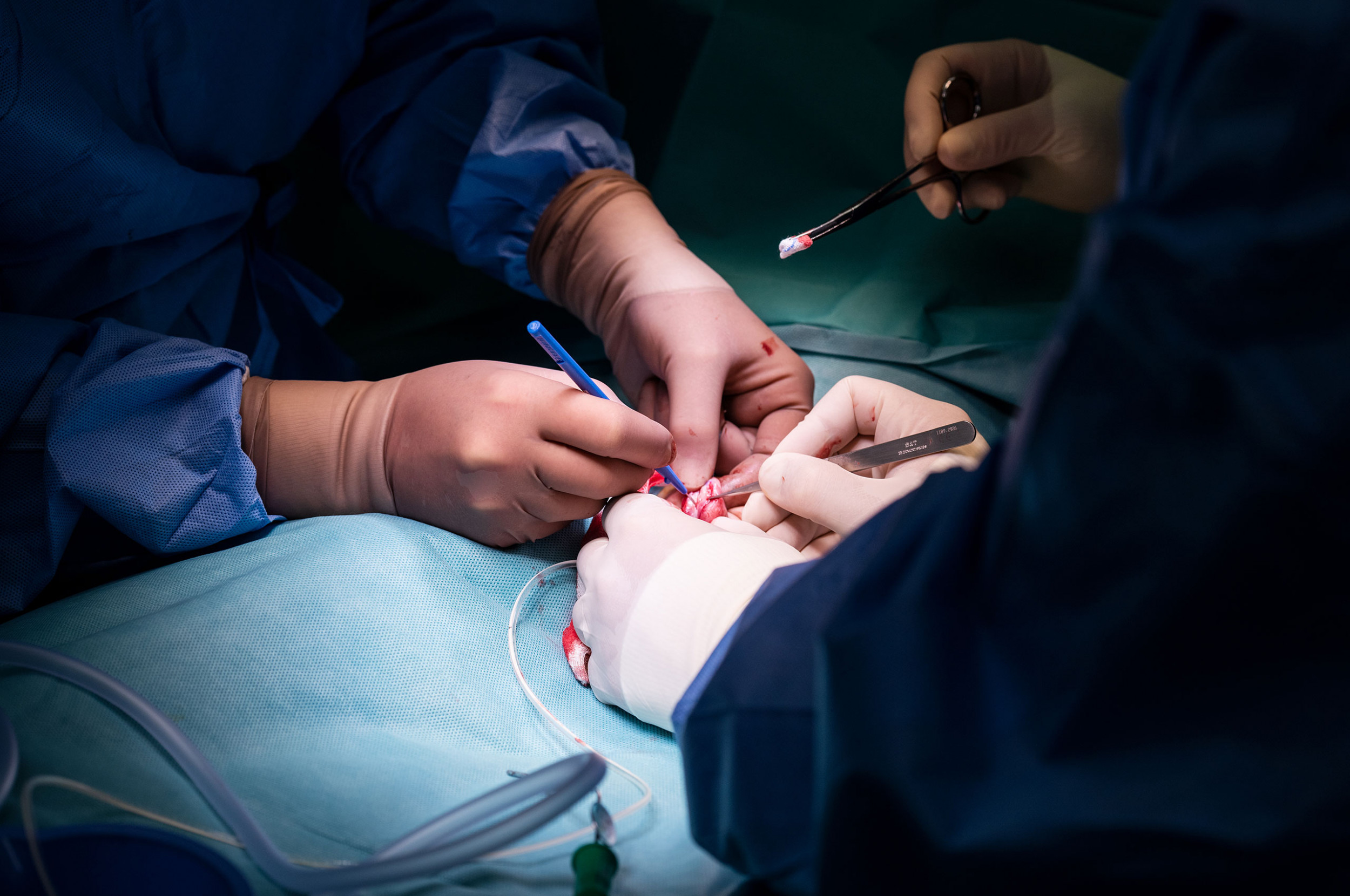 Die Hände der ChirurgInnen fotografiert während einem Eingriff