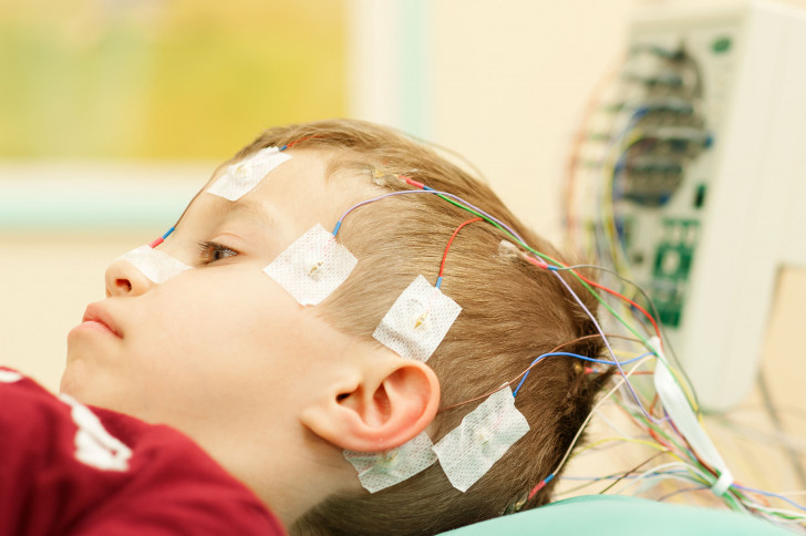 Kleiner Junge mit farbigen Elektroden auf dem Kopf während eines EEG