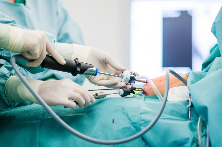 Ein Illustrationsbild von einer Operation